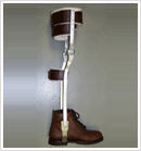 above-knee