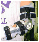 Orthotics Arm Elbow Braces