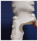 Orthotics Braces
