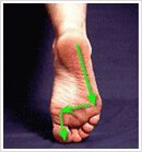 Diabetic Foot Care Management