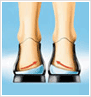 Medial and Latteral Wedges