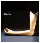 Above Elbow Braces