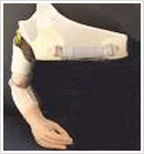 Above Elbow Braces