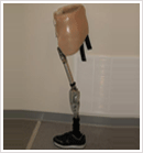 Above Knee Braces