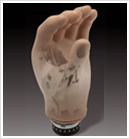 Below Elbow Braces
